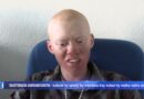 VIDEO. Une école refuse l’inscription d’un albinos pour ne pas nuire à son image